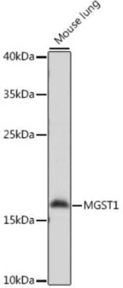Glucuronosyltransferase 1A1/UGT1A1 Rabbit anti-Human, Mouse, Rat, Polyclonal,